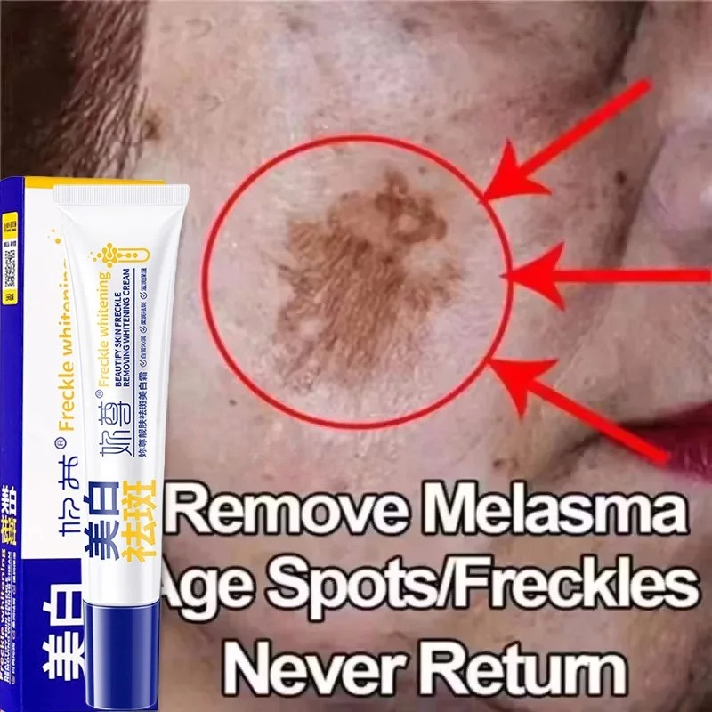 Charcoal Whitening Paste - Powerful Spot-Removing Whiten Cream Brighten Skin