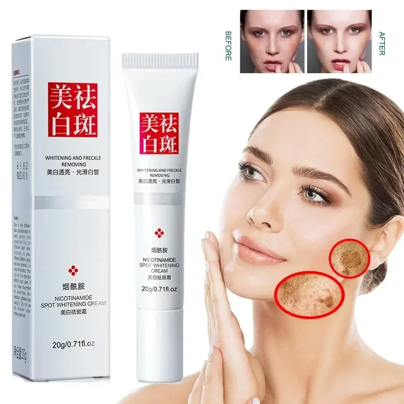 Charcoal Whitening Paste - Fades Freckle Dark Spots Face Cream