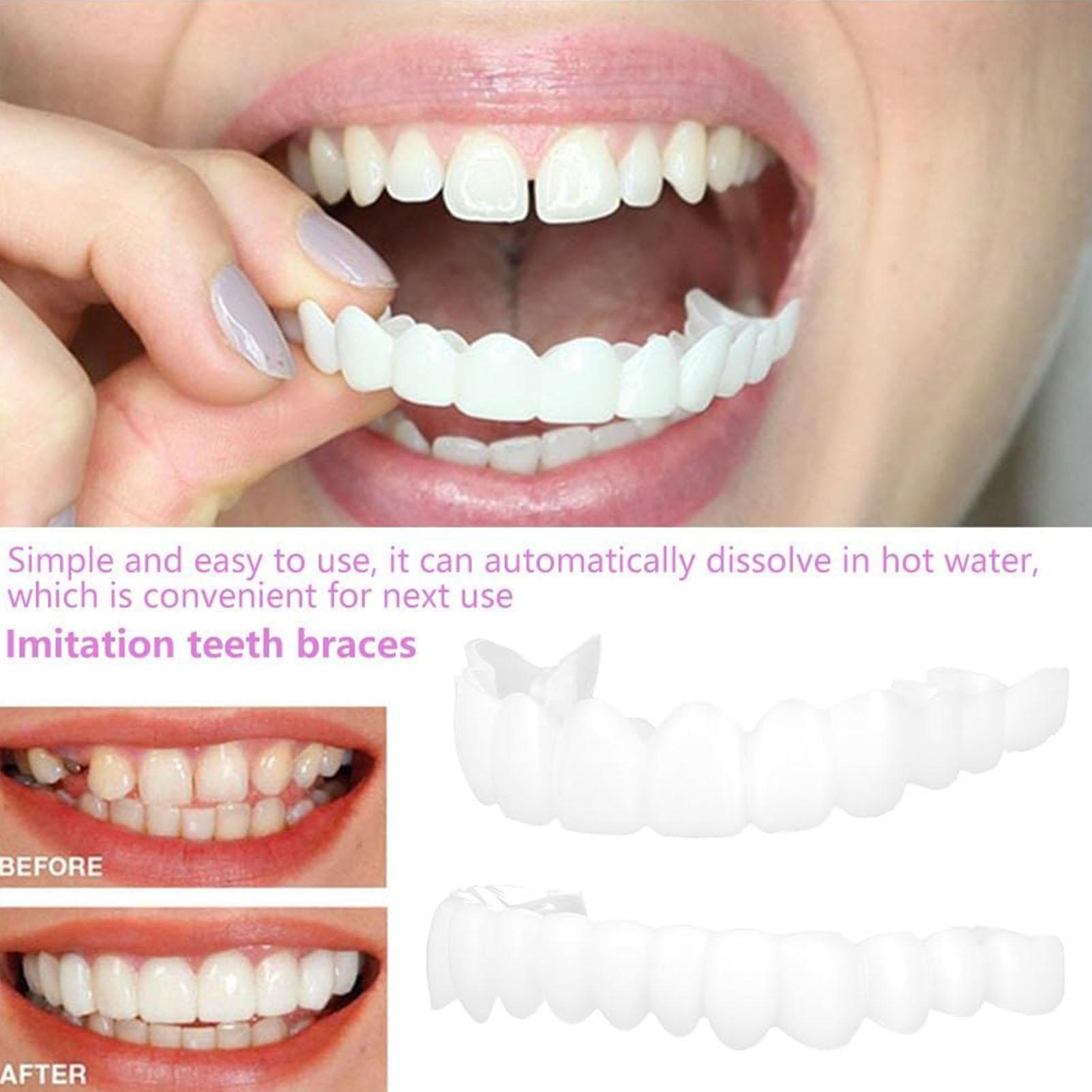 Teeth Whitening Mask - 2pcs Men Women Temporary Teeth Veneers