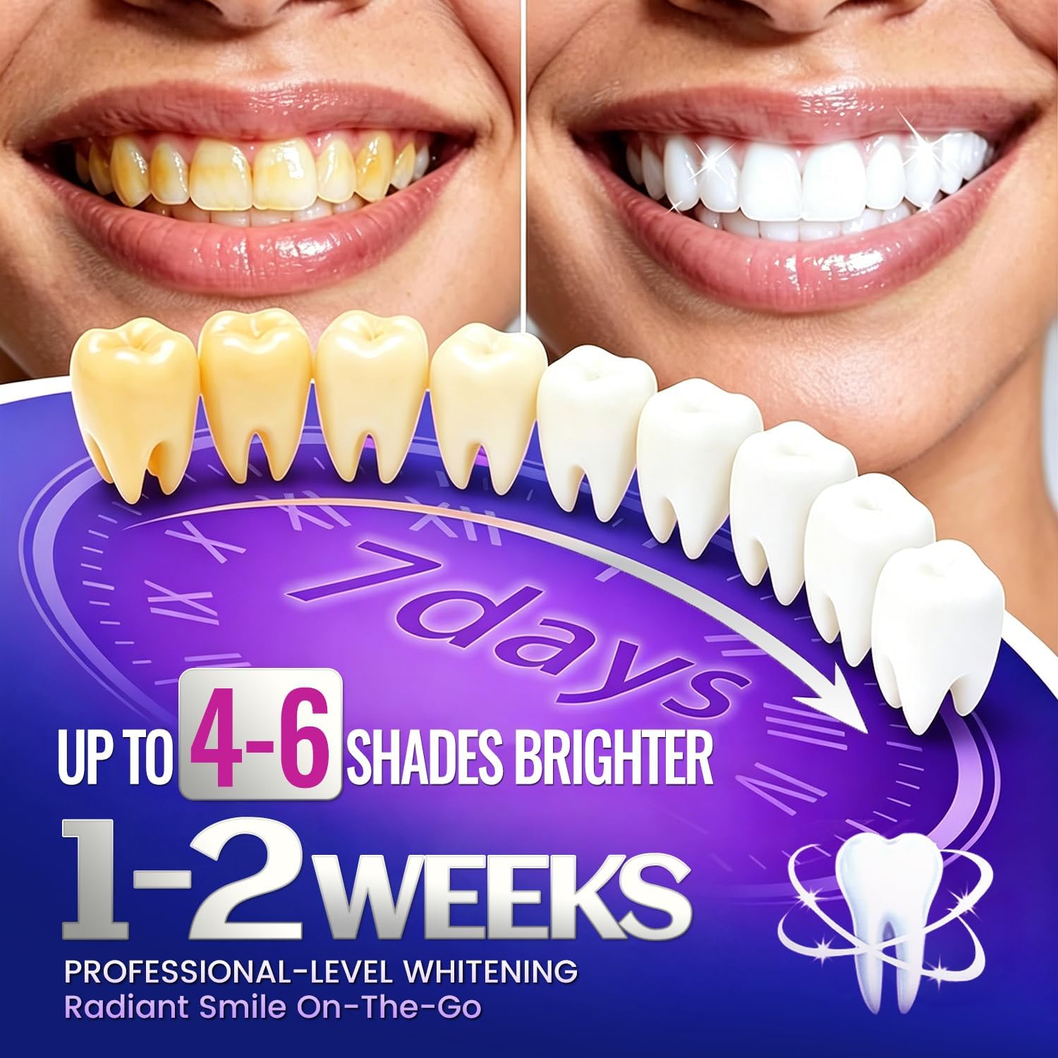 7 pairs Teeth Whitening Strips - огляд і ціна Teeth Whitening Retainer