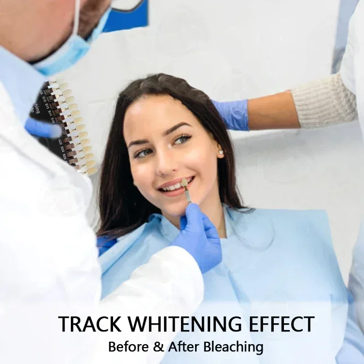 Professional Teeths Whitenings - огляд і ціна Teeth Whitening Shade Guide