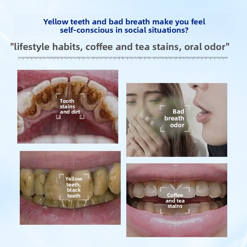 Enzyme Brightening and Whiteni - огляд і ціна Teeth Whitening Enzymes