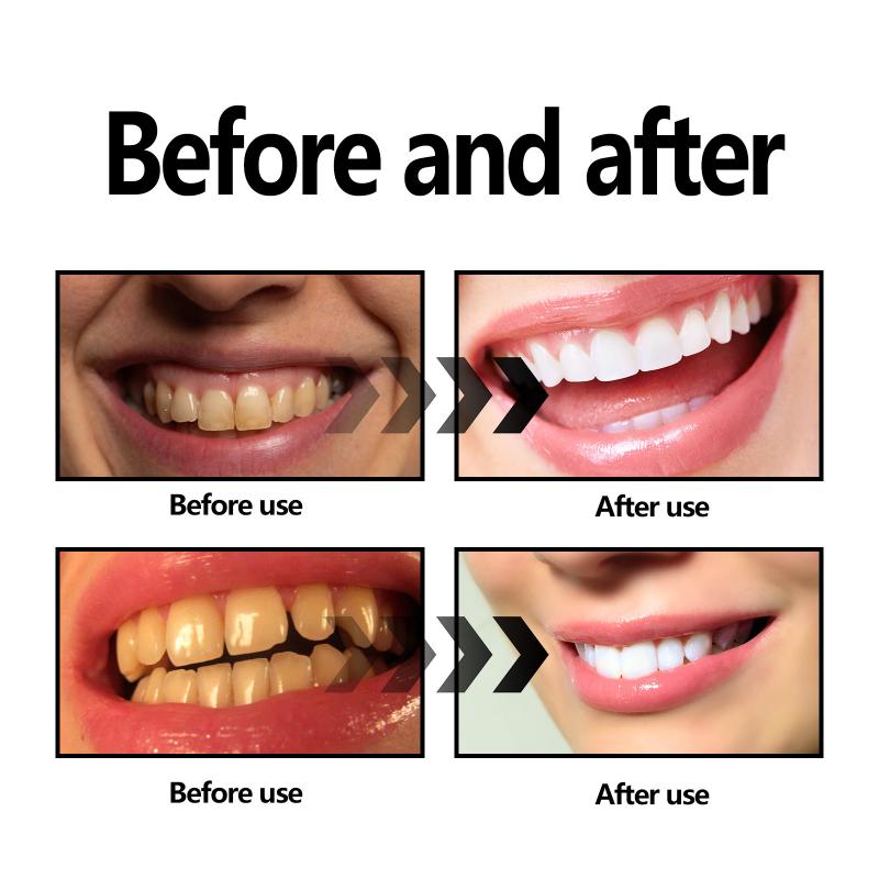 Bamboo Charcoal Powder Teeth N - огляд і ціна Teeth Whitening Filter