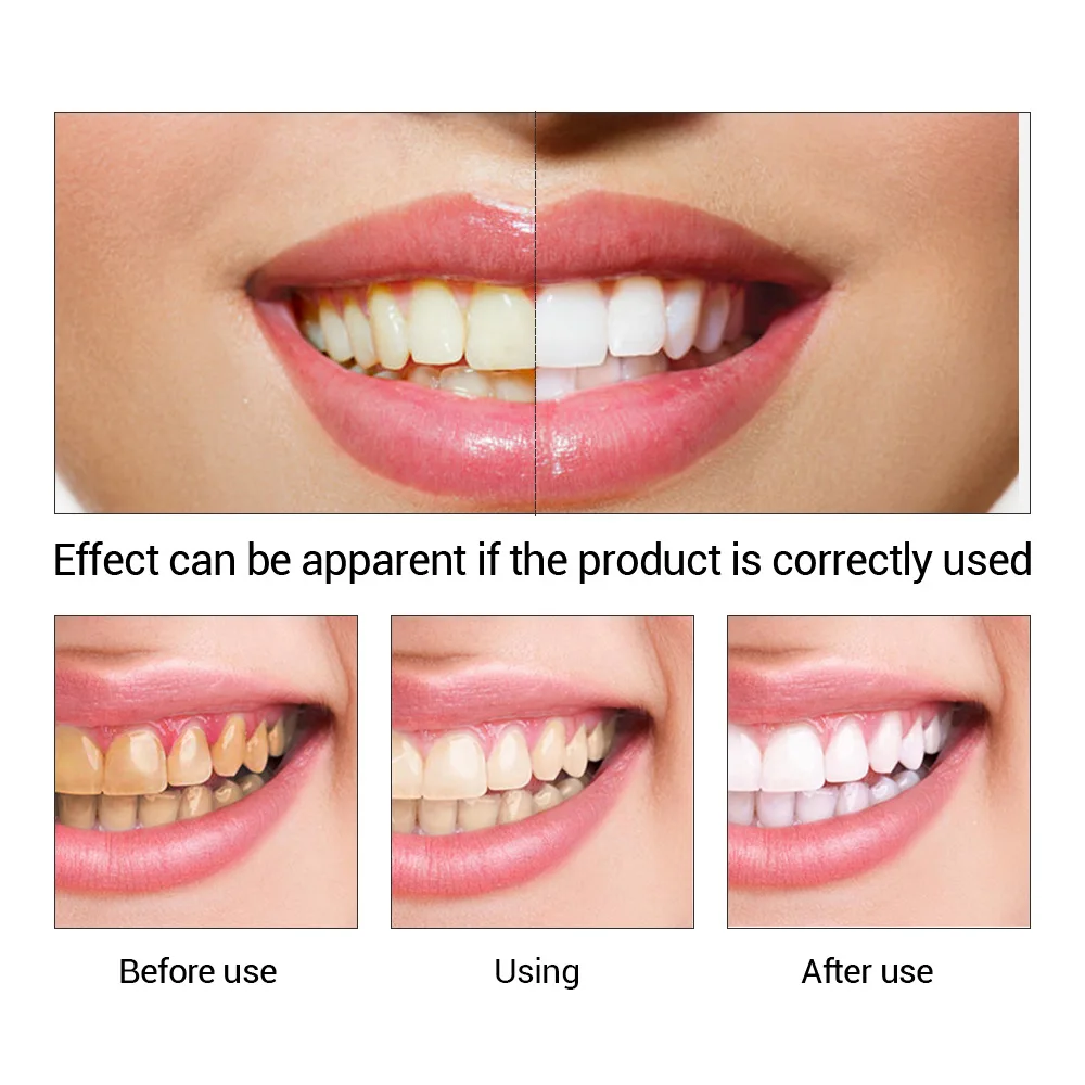 FTEENPLY Teeth Whitening Essen - огляд і ціна Teeth Whitening Powder