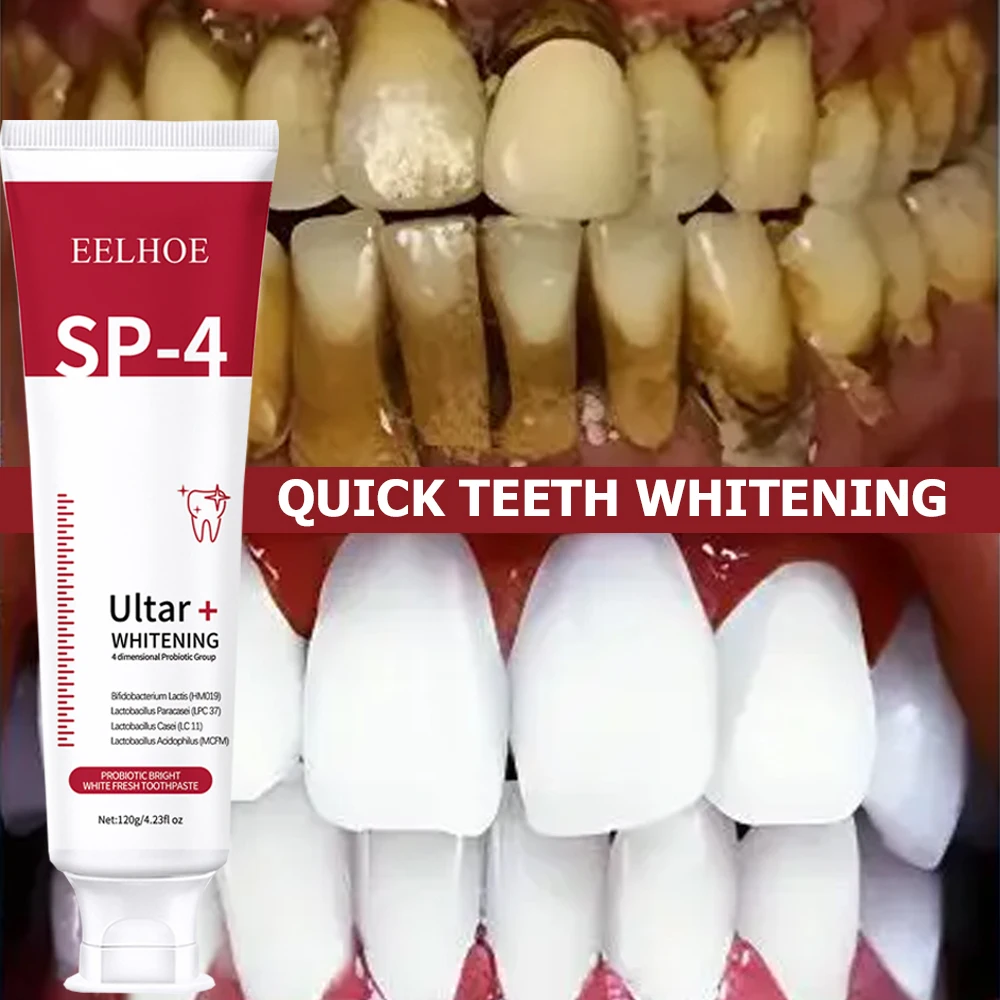 5pcs Sp-4 120g Probiotic White - огляд і ціна Teeth Whitening Enzymes