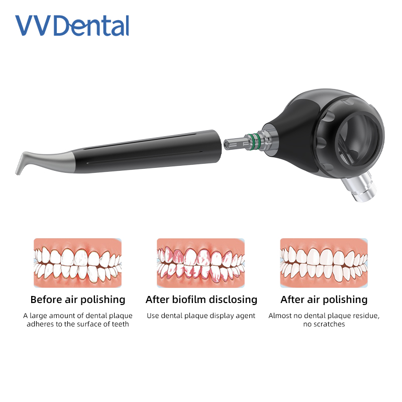 VVDental Air Polisher Jet Air  - огляд і ціна Colgate Whitening Teeth