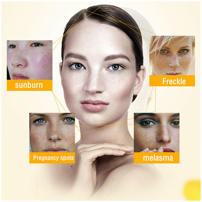 Dimollaure Whitening Freckle C - огляд і ціна Charcoal Whitening Paste
