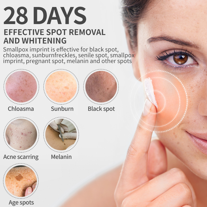 Dimollaure Whitening Freckle C - огляд і ціна Charcoal Whitening Paste