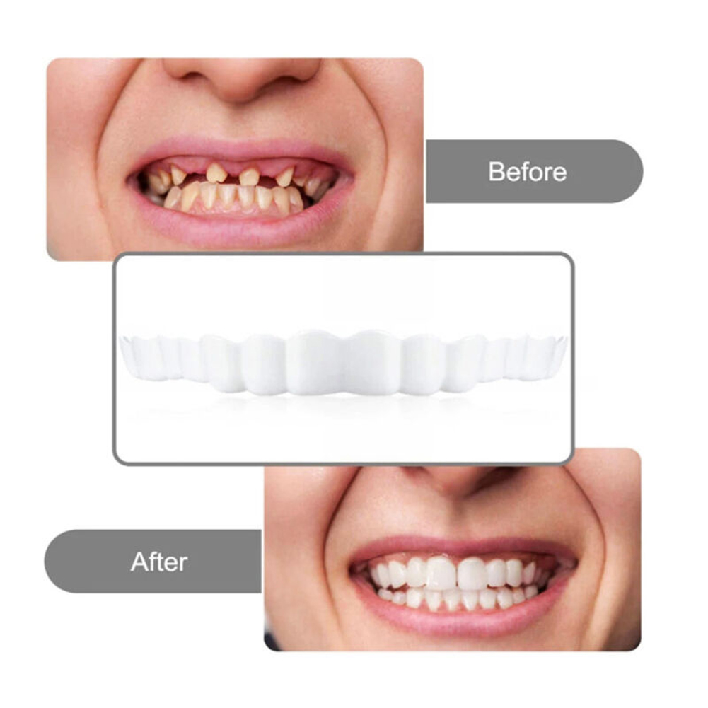 4-6 Pairs Upper&Lower Jaw Dent - огляд і ціна Teeth Whitening Mask