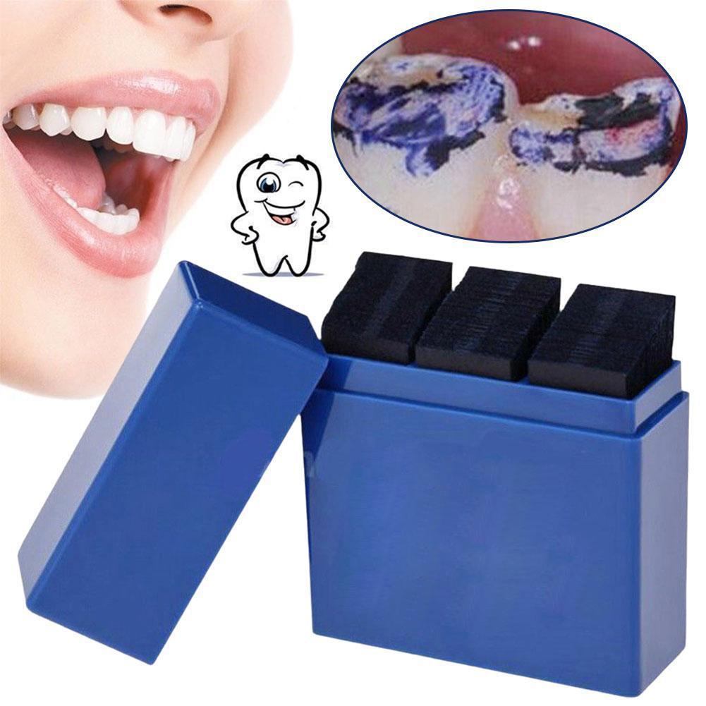 300 Sheets Dental Articulating - огляд і ціна Teeth Whitening Uk