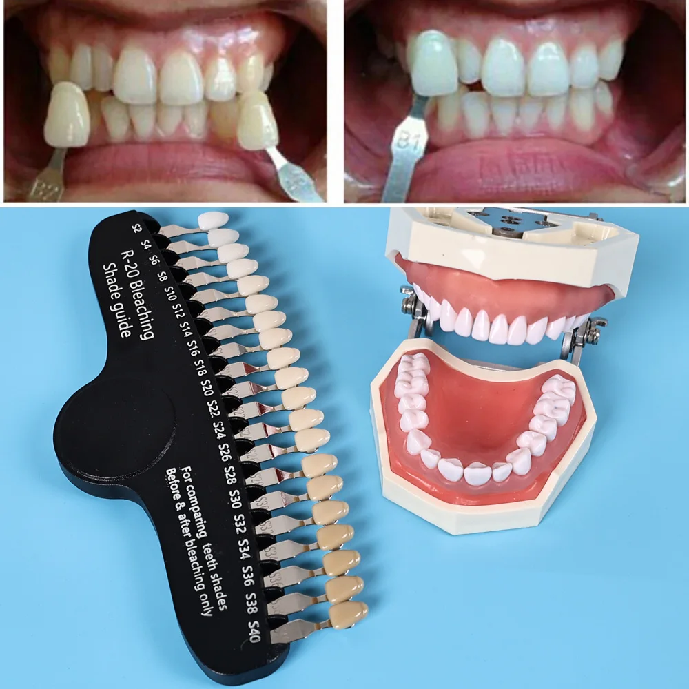 ELIJAH R-20 Bleaching Shade Gu - огляд і ціна Teeth Whitening Shade Guide
