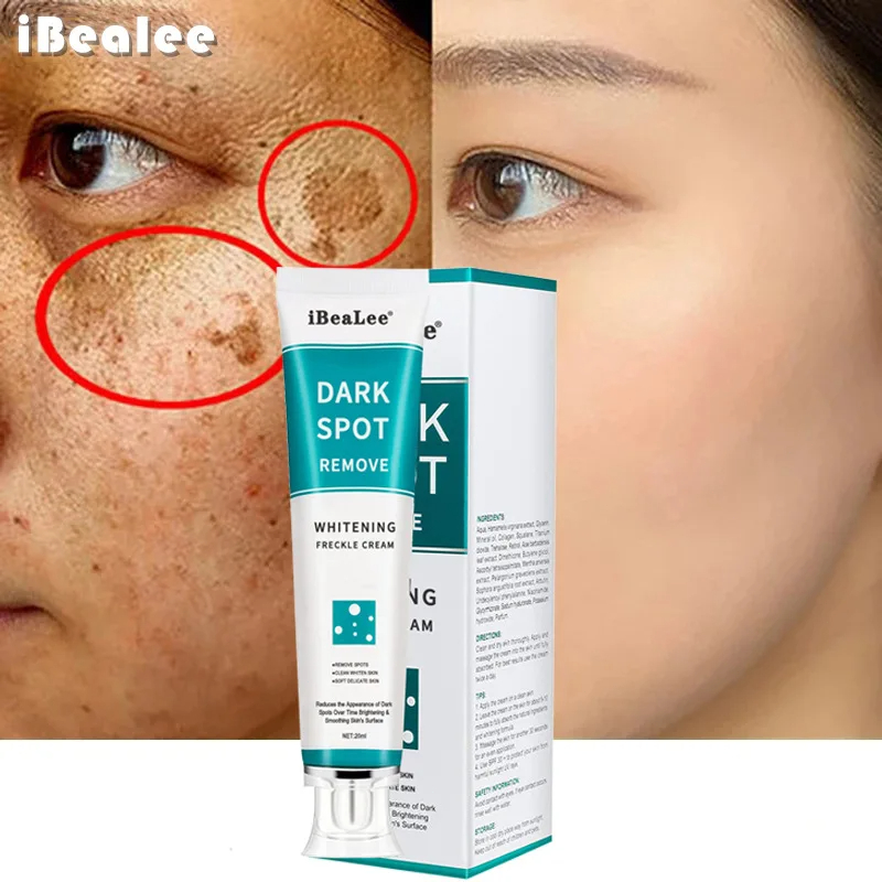 Whitening Freckle Cream Remove - огляд і ціна Charcoal Whitening Paste