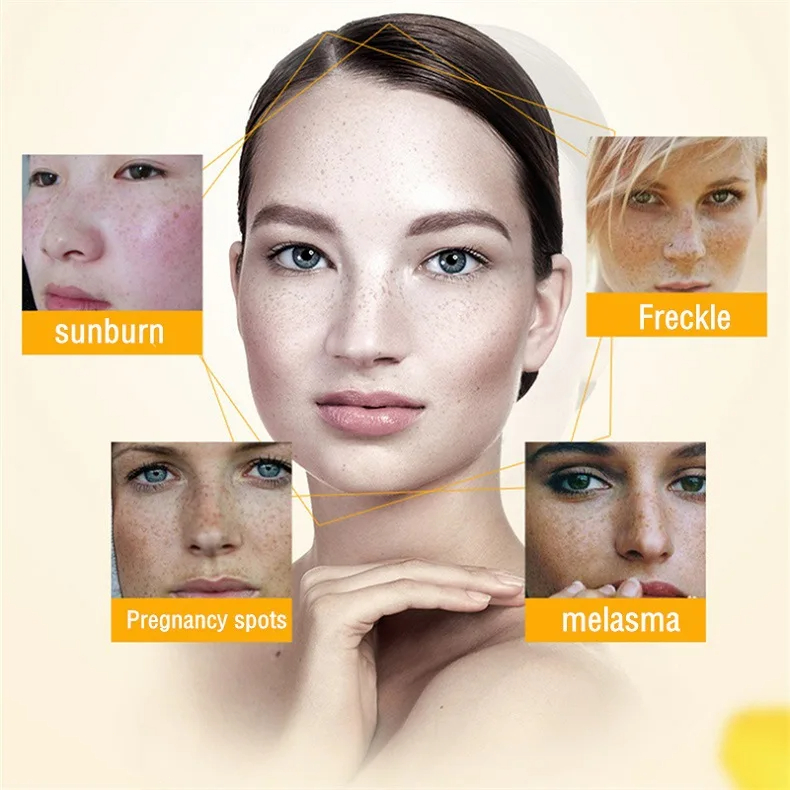 Whitening Freckle Cream Remove - огляд і ціна Charcoal Whitening Paste
