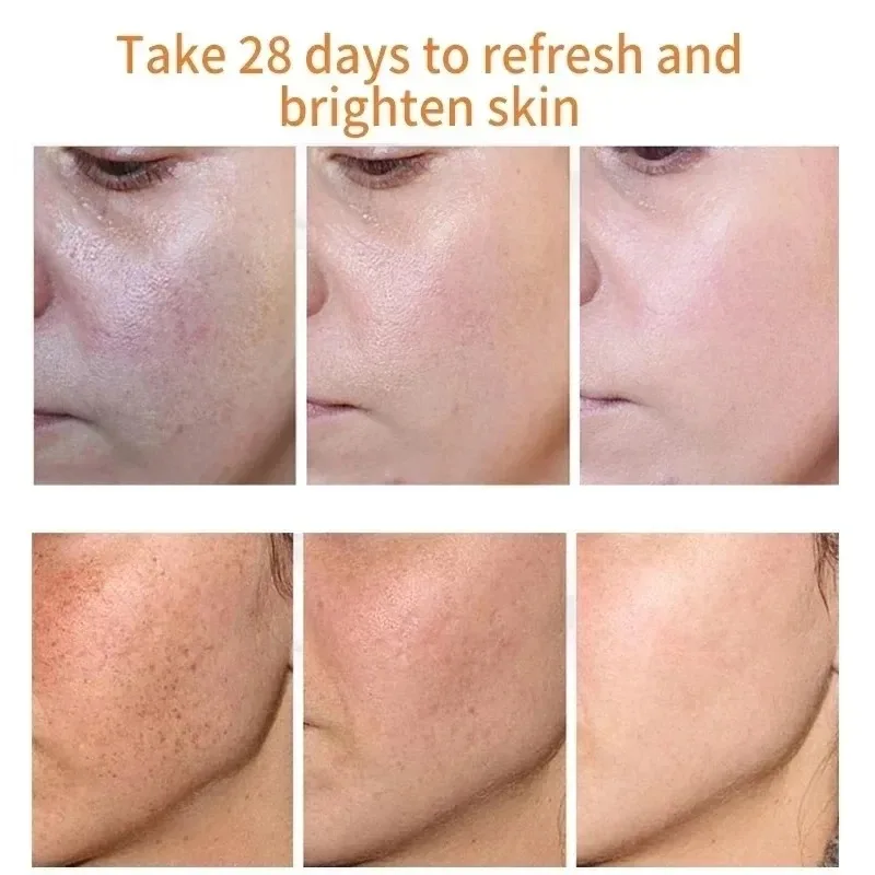 Fades Freckle Dark Spots Face  - огляд і ціна Charcoal Whitening Paste