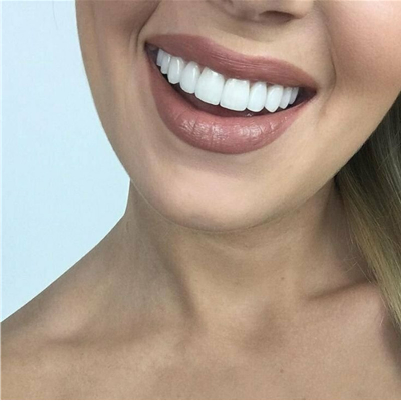 Whitening Teeth Veneers Tempor - огляд і ціна Teeth Whitening Mask