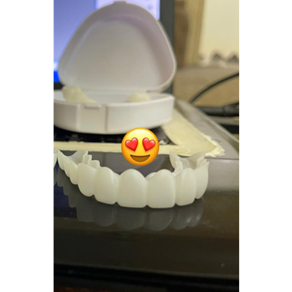 On Smile Dental Upper Lower Fa - огляд і ціна Teeth Whitening Mask