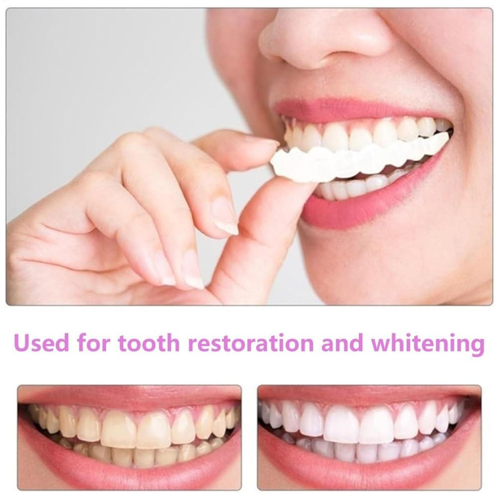 2pcs Men Women Temporary Teeth - огляд і ціна Teeth Whitening Mask