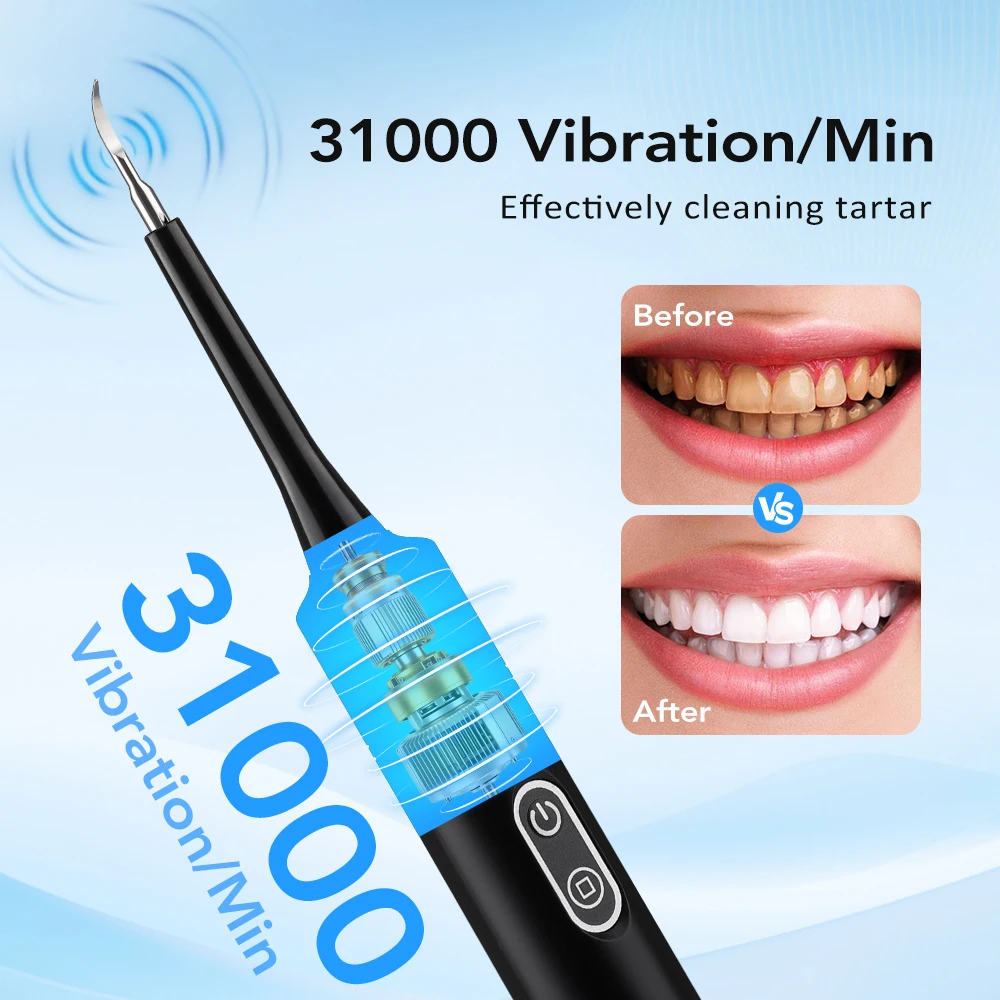 Electric Sonic Vibration Denta - огляд і ціна Teeth Whitening Uk