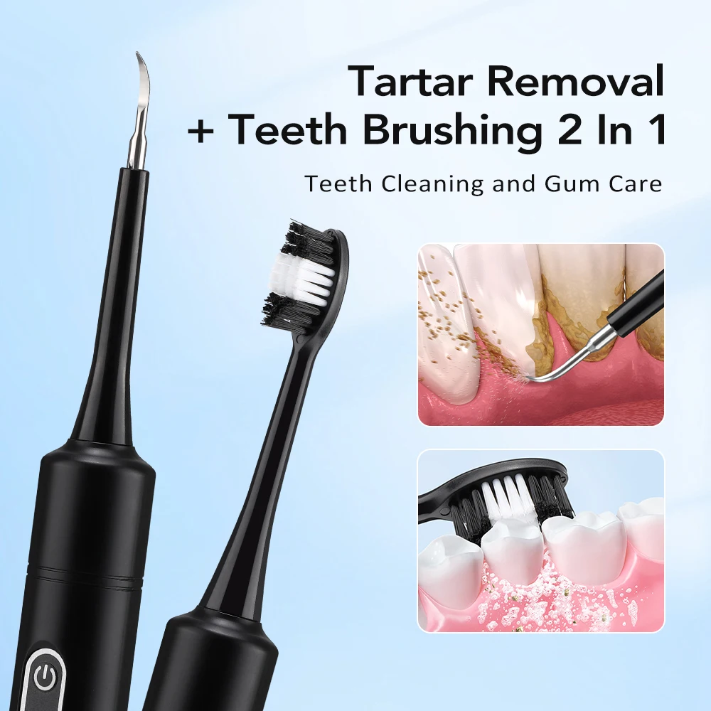 Electric Sonic Vibration Denta - огляд і ціна Teeth Whitening Uk
